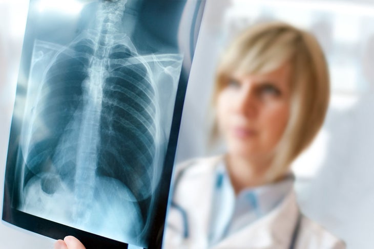 Pneumonia and bronchitis can happen when a cold/flu is not properly treated or becomes chronic.